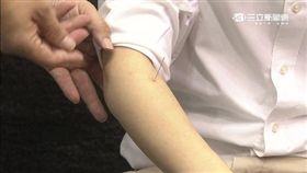 中醫,強迫,自費,健保