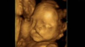 辣媽懷孕6月！超音波見「胎兒笑」被感動…醫生嘆：流掉吧（圖／翻攝自微博）