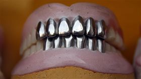 牙醫,假牙,齒模,全口重建,牙科（示意圖／pixabay）