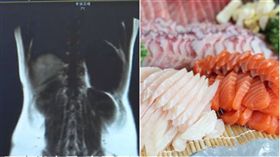 福建,寄生蟲,罹患肝吸蟲感染症,生魚片,發燒(圖/翻攝自幫視頻、PIXABAY)