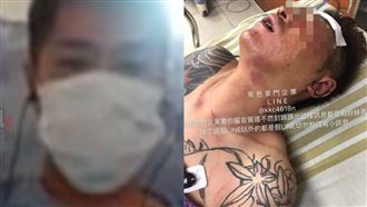 吳小哲斷手腳首露面！泣：對不起爸爸