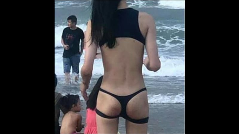 泳褲挖洞露美尻　辣妹正面曝網暈倒