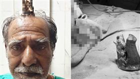 印度,惡魔角,老翁,皮脂角,剃刀
https://twitter.com/EyeWitness101/status/1174181130641256451