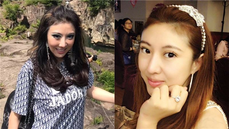 罕病兒判活不過3歲！女星：想一起走