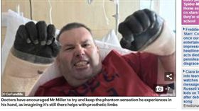 澳洲雪梨,截肢,喉嚨痛,感染　（圖／翻攝自每日郵報）