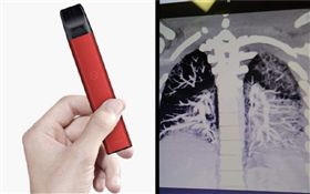 電子菸,菸油,肺病,美國,賓州（圖／翻攝自微博；臉書）