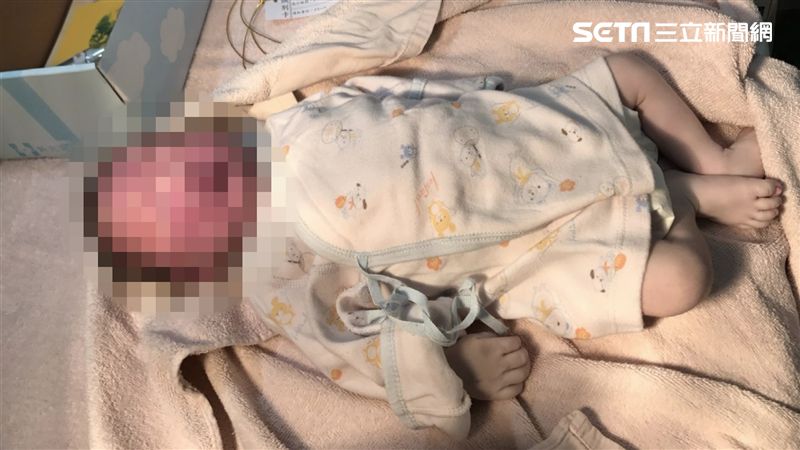 子宮破裂釀嬰亡　資深婦科醫師說話了