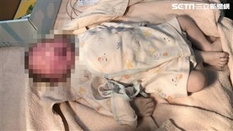 產婦命危、男嬰臉黑亡　醫師痛心回應