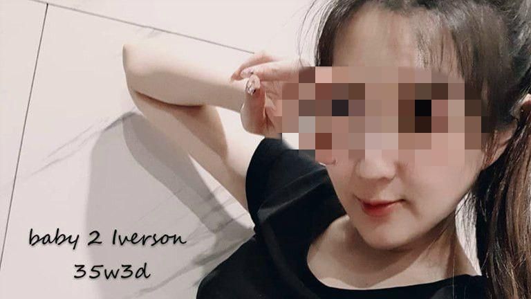 子宮破裂兒臉黑死　孕婦暫脫離險境