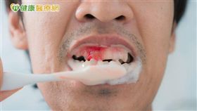 王建得主任呼籲，若身上出現不明出血，且症狀持續長達一、兩週以上，無論出血症狀嚴重與否，民眾千萬不得輕忽，若不及早就醫，很有可能長期處於無預警的危險之中；若檢查發現血小板數值低於三萬，更應積極治療。