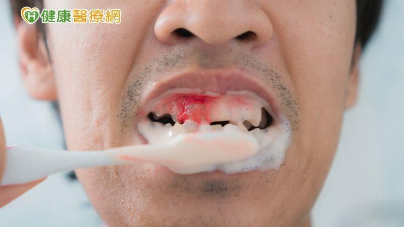 「血盆大口」流血不止　原來是紫斑症