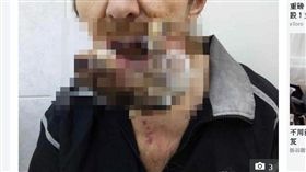 （圖／翻攝自太陽報）俄羅斯,腫瘤,祈禱,癌症,痊癒