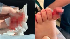 夾傷,門縫,打拇指,澳洲,昆士蘭,托兒所,送醫,救護車,神經,受損 圖／翻攝自Taylor Madison臉書