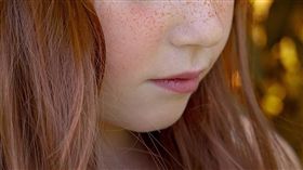 雀斑,翻攝自pixabay