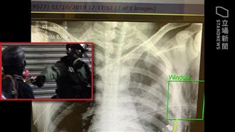 離心臟3公分…港生中彈命危　畫面曝