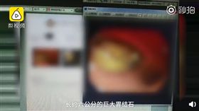 （圖／翻攝自梨視頻）中國,南昌,芒果,胃結石,可樂