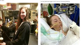 英國,少女,感染,霉菌孢子（圖／翻攝自鏡報）