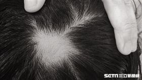 圓禿（讀者提供）