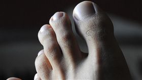 腳指甲怎麼剪？醫師曝正確剪法　網友驚呆：我剪錯30年…　（圖／翻攝自Pixabay）