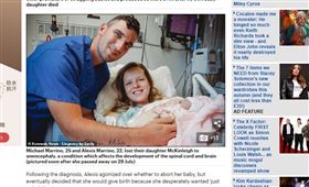 美國,無腦畸形,產檢。(圖/翻攝自dailymail)