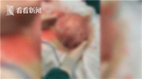 大陸,肉瘤,子宮肌瘤。(圖/翻攝自看看新聞)