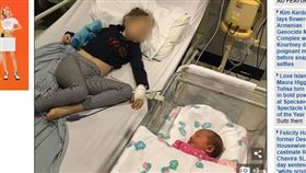 英國,罕病,畸形。(圖/翻攝自dailymail)