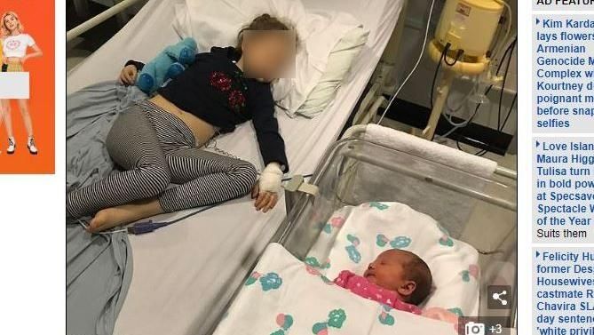 6年做25次手術　罕病姊苦等妹出生