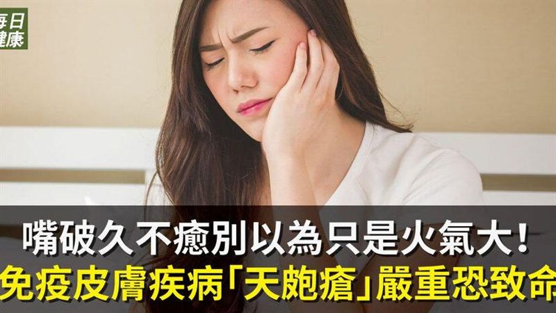 嘴破別以為只火氣大！天皰瘡恐致命