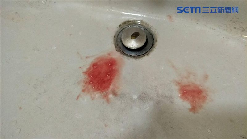 「吐血」快就醫　牙周病比你想像可怕
