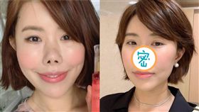 南韓知名部落客、台灣媳婦「金老佛爺」（金楨美）/鼻子整容手術後照片。翻攝IG