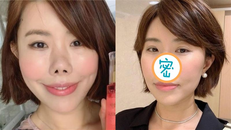 維修豬鼻成果曝光！網一看驚呼：美翻