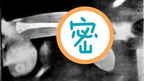 網路流傳一張疑港警遭示威者打斷生殖器的照片，引發網友熱議。（圖／翻攝自爆廢公社）