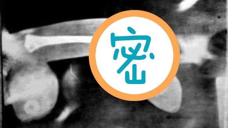 網傳疑示威者斷港警陰莖骨？醫說話了