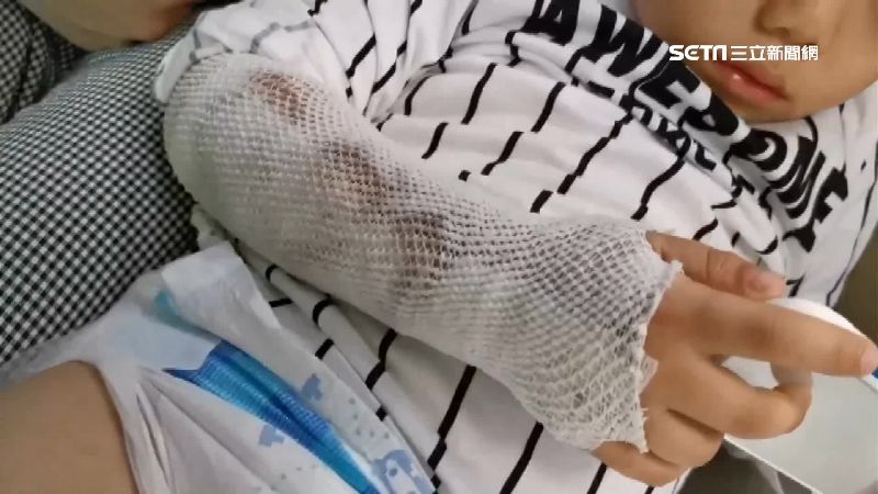 併桌吃麵看小女童燙傷　她遭母斥冷血吞屈