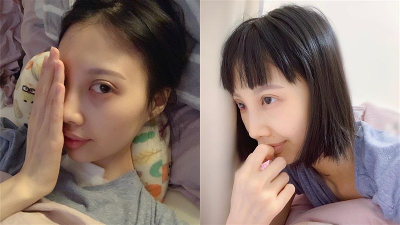 腫瘤爬滿身！女星術後再曝罹患這病