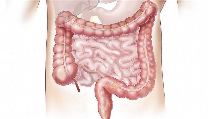 化療癌患如何食補？腫瘤科醫師教戰！