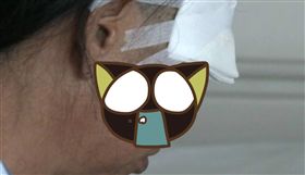 廣東,深圳,臉,樹姿,車禍,摔車,臉頰,傷口,發炎,處理,異物,張嘴,　圖／翻攝自微博