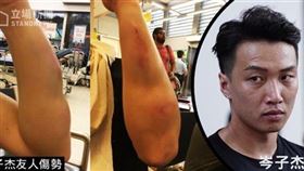 香港泛民主派團體,岑子杰,遇襲送醫,完成急救,情況穩定(圖/立場新聞)