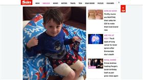 男童打翻熱茶…全身皮膚5%面積燒燙傷　一動作救回0疤痕
圖／翻攝自太陽報