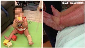 保母,燙傷,男嬰,業務過失致重傷害,士林