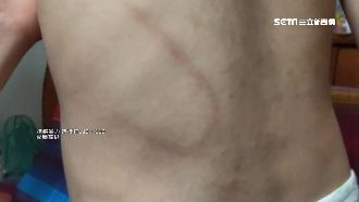 狠父衣架虐打4歲童　爺見狀提告傷害