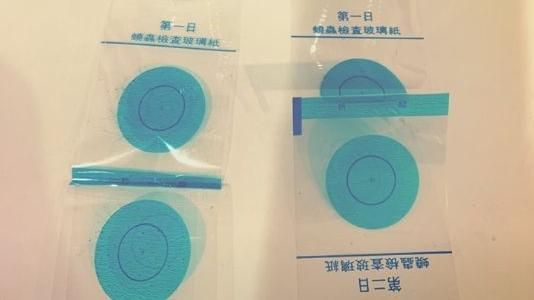 學校蟯蟲檢查！兒緊黏半天　媽秒笑噴
