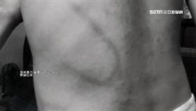 北投,台中,虐童,阿公,衣架,虐打,傷害,瘀青,家暴（圖，經變色處理／翻攝畫面）