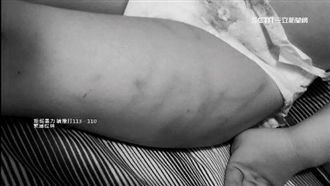 孫遭虐打還捱餓　爺怒：兒子吃得像豬