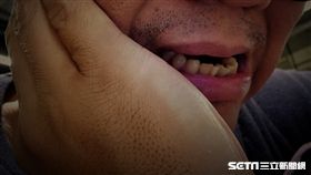 牙科,牙齒,牙痛