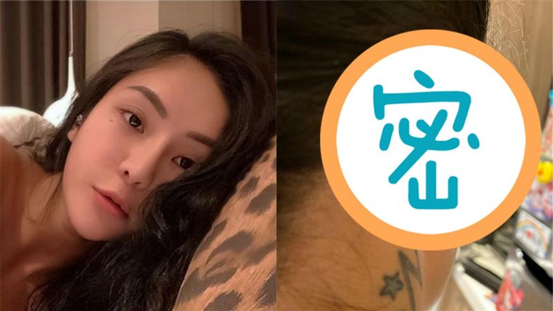打耳洞腫到變形！她延誤就醫下場超慘