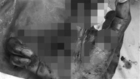  鞭炮,喝酒,酒醉,手掌,遲鈍,反應,英國,木工,中指,外星人,復健,萬聖節,警告, 圖／翻攝自推特