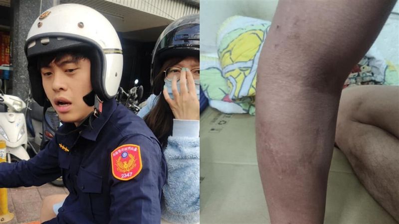 屁蛋妹反控滿手針孔　網友秀手臂自清