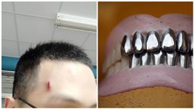 老婆婆打噴嚏…假牙飛出！他額頭遭砸縫4針　網笑：牙起來（圖／翻攝自Dcard、PIXABAY）