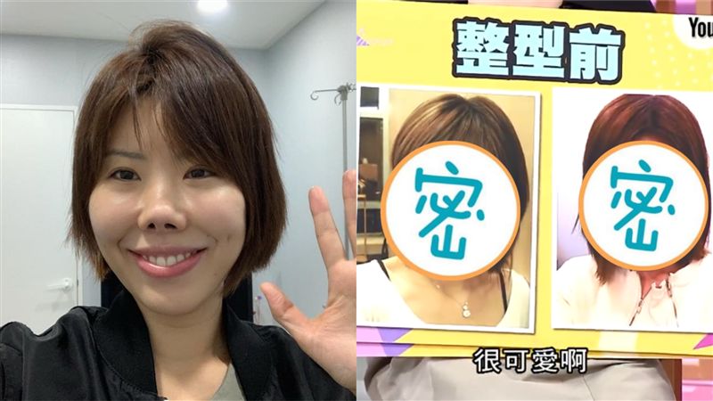 整鼻前照曝！金老佛爺鬆口手術總金額